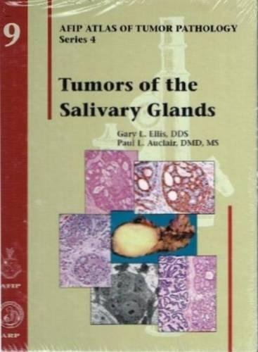 Tumors of the Salivary Glands (AFIP Atlas of Tumor Pathology: Series 4) [Hardcov