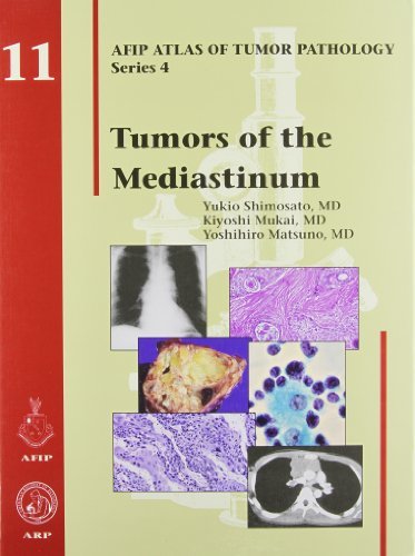 Tumors of the Mediastinum (Atlas of Tumor Pathology) [Hardcover] Shimosato, Yuki