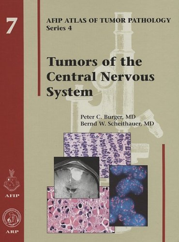 Tumors of the Central Nervous System (Afip Atlas of Tumor Pathology) [Hardcover]