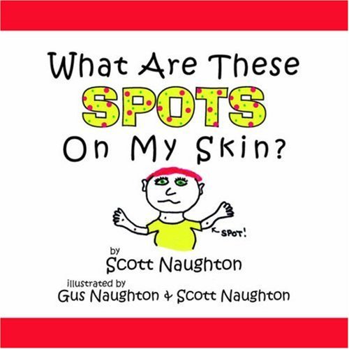 What Are These Spots On My Skin? [Paperback] Naughton, Scott