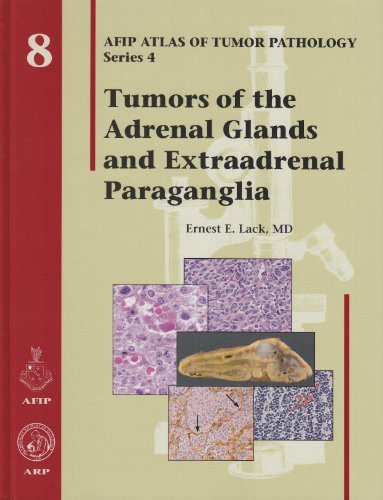 Tumors of the Adrenal Glands and Extraadrenal Paraganglia - Volume 8 (Afip Atlas