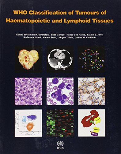 WHO Classification of Tumours of Haematopoietic and Lymphoid Tissue [OP] (Medici